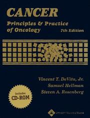Cancer principles & practice of oncology