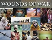 Wounds of war